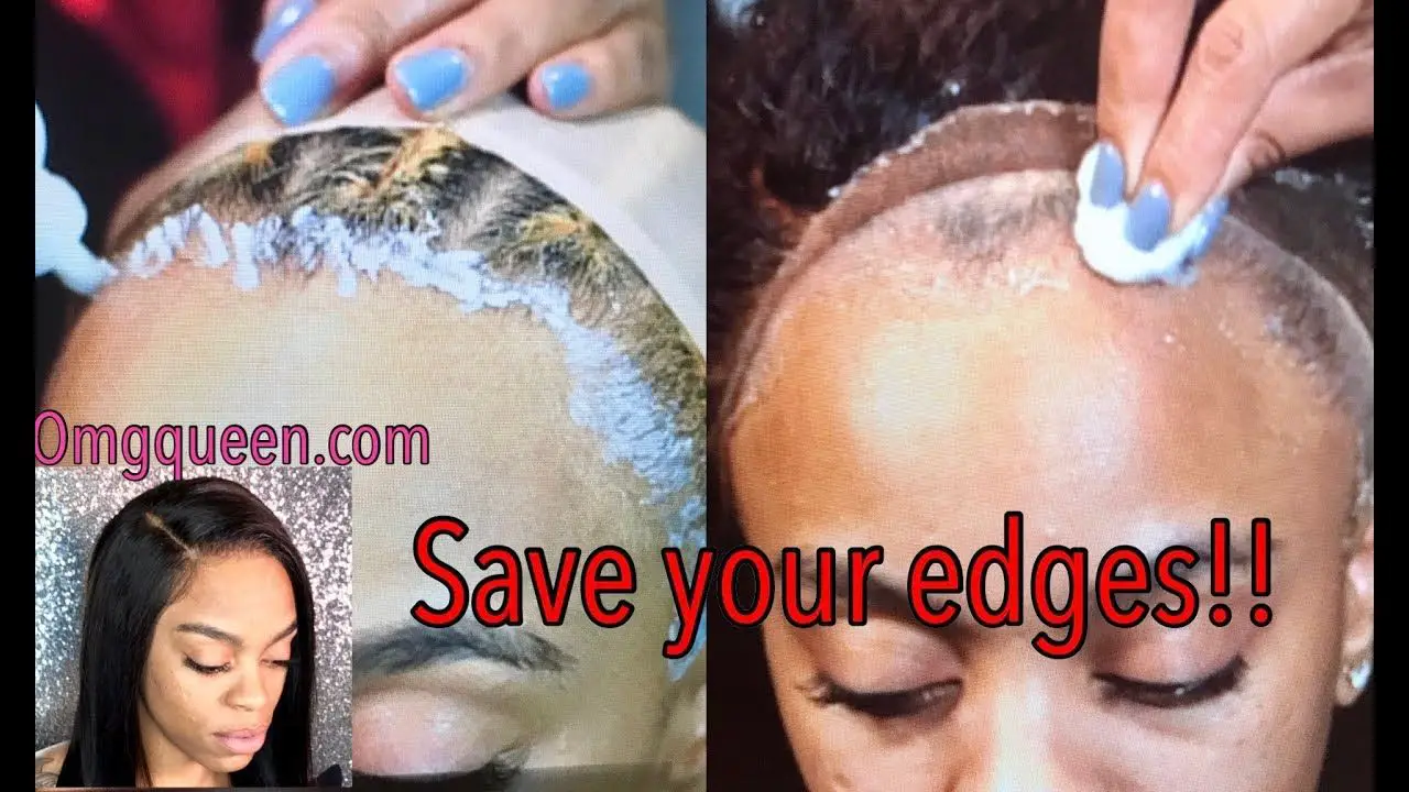 How To Remove Lace Glue From Your Hair